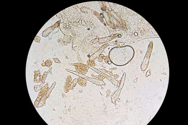 Un acarien microscopique observé au microscope parmi des débris organiques.