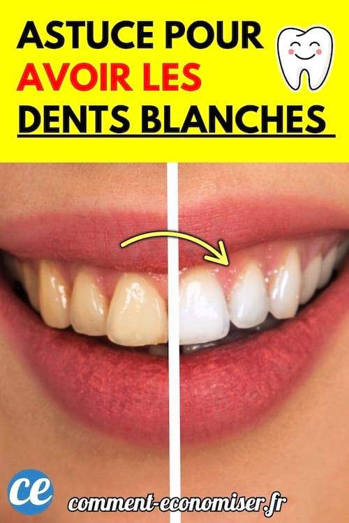 Un sourire montre la différence de teinte entre des dents jaunes et des dents blanches, séparées par une ligne centrale.