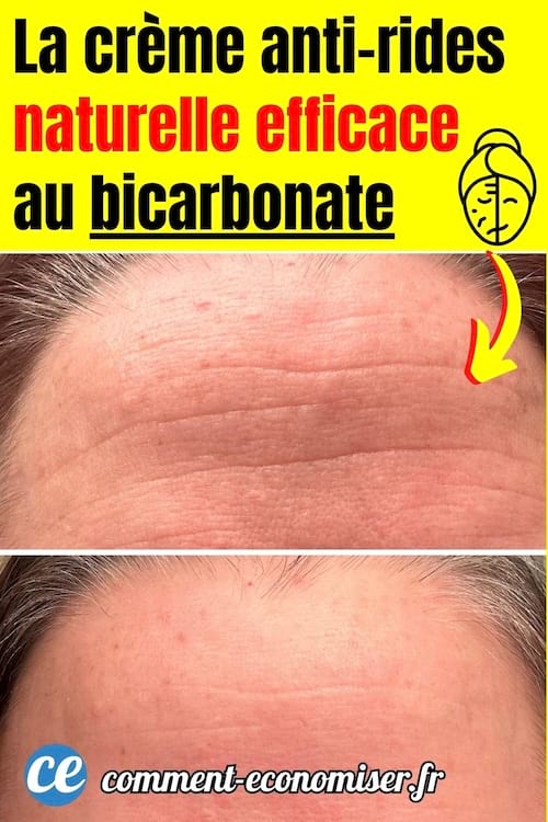 une photo de front avec des rides avant et après un traitement anti rides