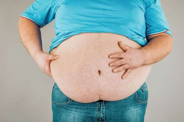Un homme en surpoids tient son ventre avec ses mains.