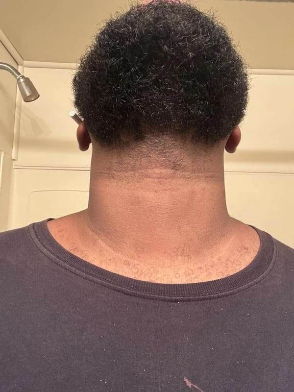 Nuque avec coupe de cheveux créant une illusion visuelle.