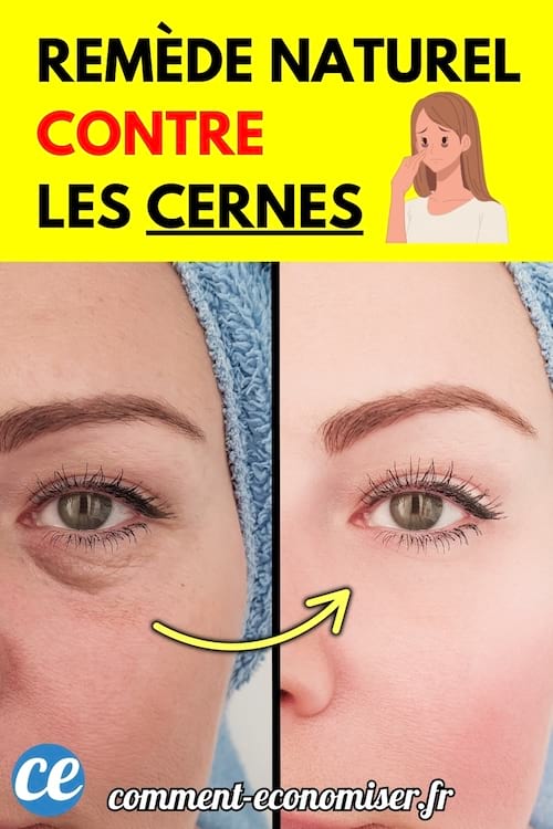 Comparaison du contour d’un œil avec cernes à gauche et sans cernes à droite, séparés par une flèche jaune.