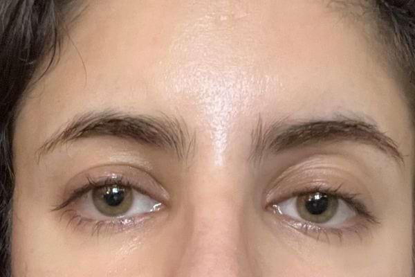 Un visage avec des yeux fatigués et des cernes visibles.