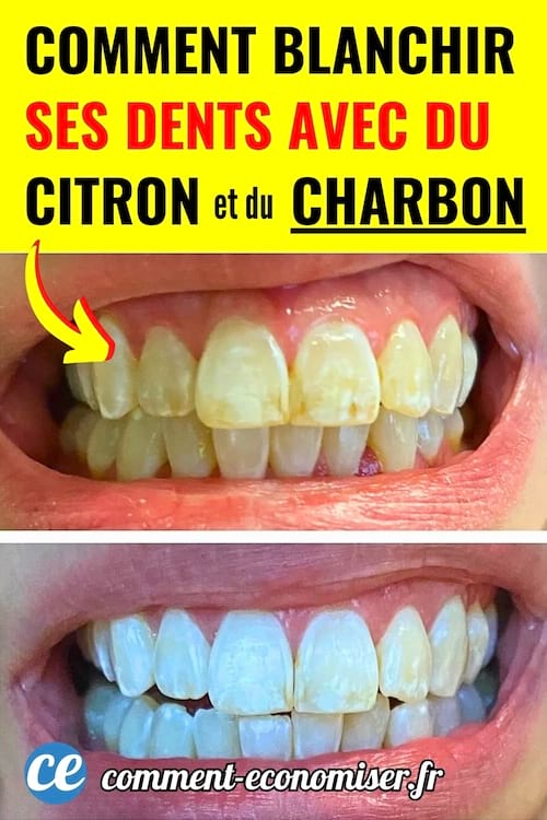 Des dents jaunes avant et après blanches grâce au citron et charbon