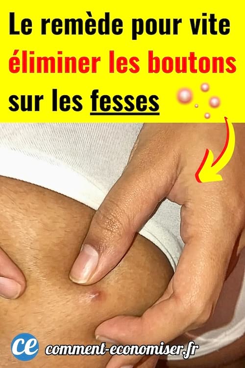 Des boutons aux fesses qui vont être enlevés