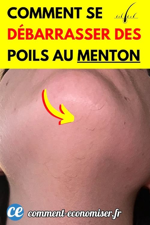 une jeune femme avec des poils au menton