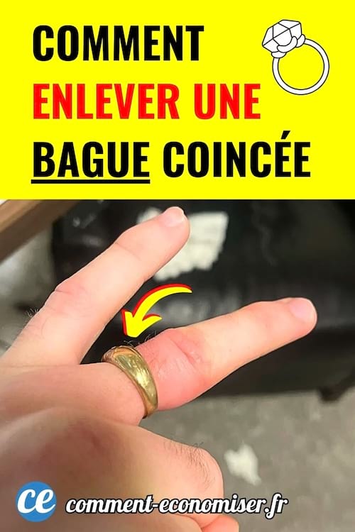 Doigt gonflé avec bague dorée coincée et flèche jaune montrant comment la retirer facilement.