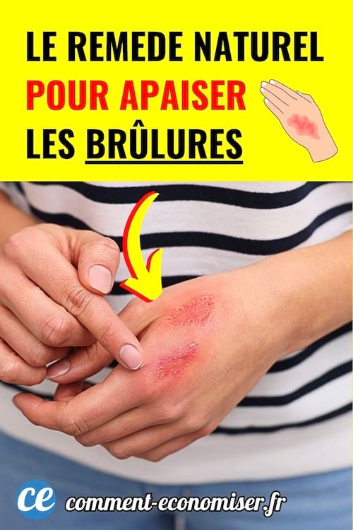 Main brûlée avec rougeurs visibles, flèche jaune montrant la zone irritée.