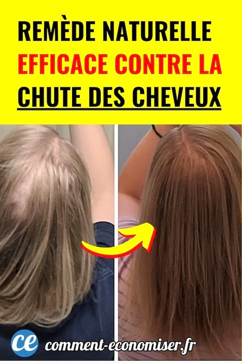 Comparaison avant-après d’une chevelure clairsemée puis plus dense, flèche jaune entre les deux.