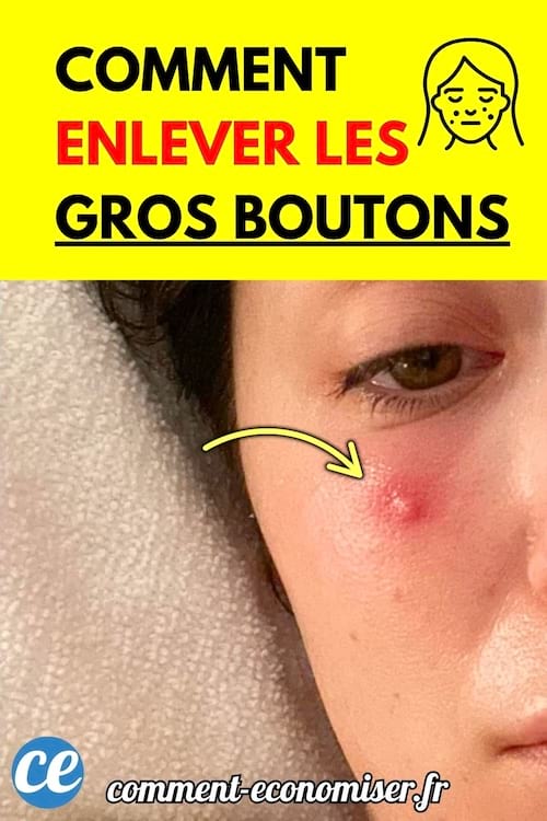 Femme avec un gros bouton rouge sur la joue.