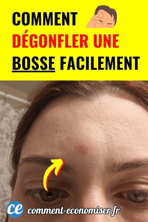 Femme avec bosse sur le front, flèche jaune, fond jaune vif, texte rouge et noir.