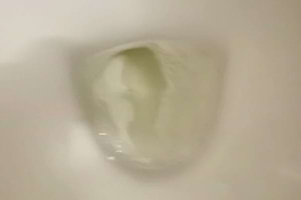 Urine blanche dans une cuvette de toilettes.