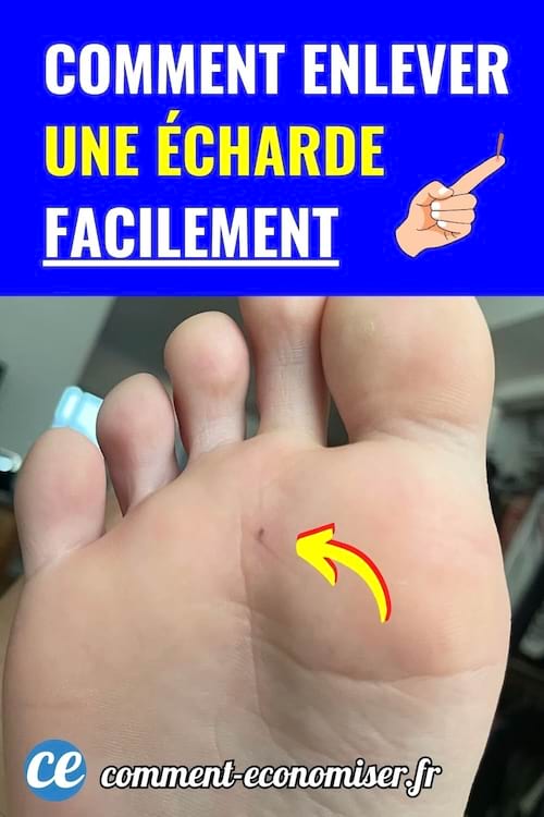 Pied avec écharde sous la peau, flèche jaune, fond bleu vif, texte blanc et jaune.
