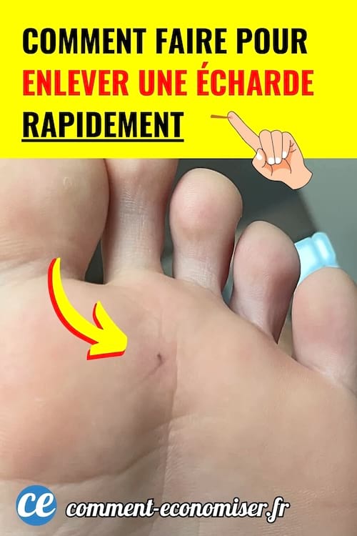 Pied avec une petite écharde plantée sous la peau.