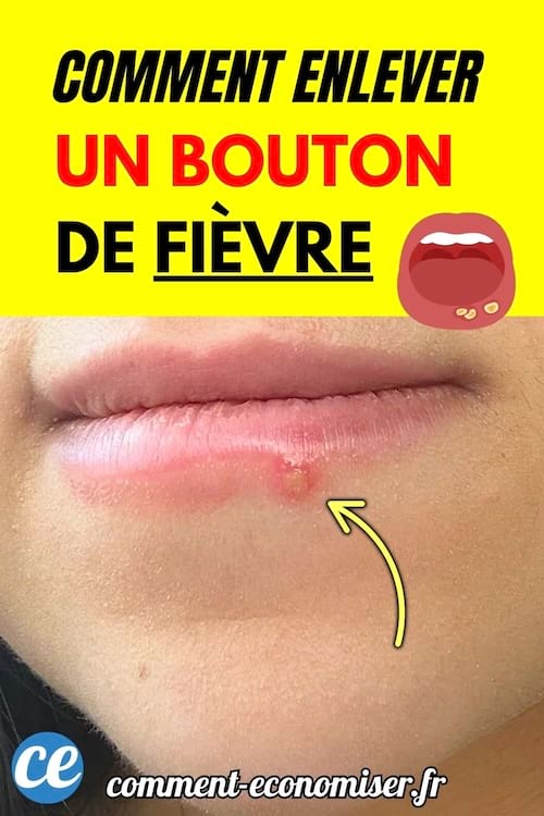 Lèvre inférieure avec un bouton de fièvre rouge et irrité.