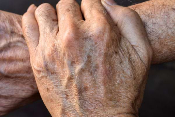 Une main âgée ridée et tachetée posée sur le bras d’une autre personne.