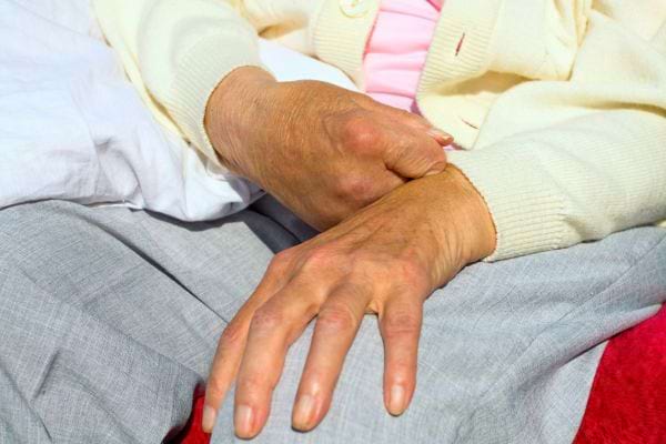 Une personne âgée pose ses mains sur ses genoux, vêtue d’un gilet clair et d’un pantalon gris.
