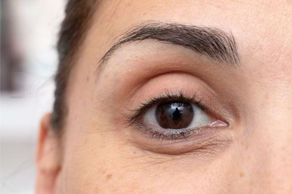 Gros plan sur l’œil d’une femme montrant les détails des cernes.