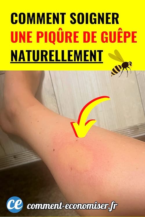 Jambe avec rougeur causée par une piqûre de guêpe, indiquée par une flèche jaune.