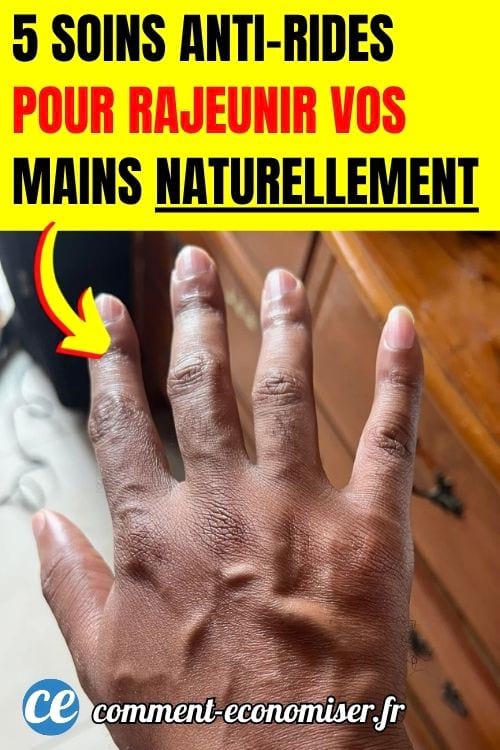Une main d'une femme jeune qui montre des signes de vieillissement de la peau.