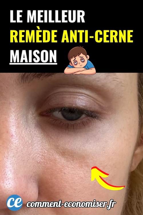 Œil fatigué avec cerne visible, flèche jaune, texte noir et jaune sur fond noir.