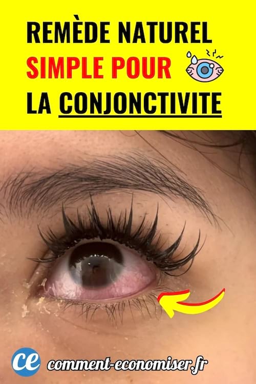 &OElig;il rouge irrit&eacute; avec fl&egrave;che jaune, fond jaune vif, texte noir et rouge.