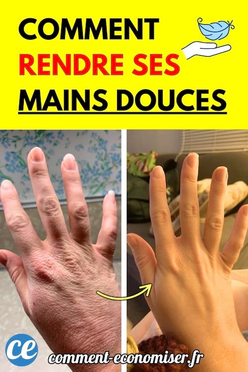 Comparaison mains sèches et mains douces après soin.