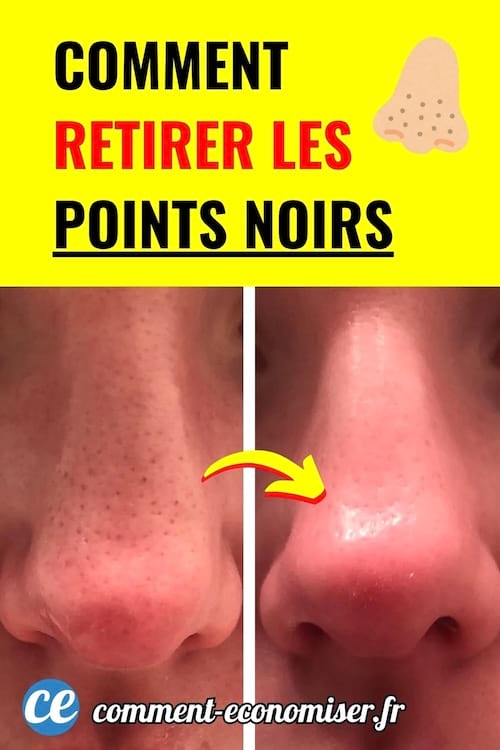 Avant après montrant un nez avec points noirs puis propre après un soin naturel.