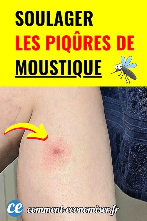 Bras avec bouton rouge de piqûre de moustique et flèche jaune indiquant la zone irritée.