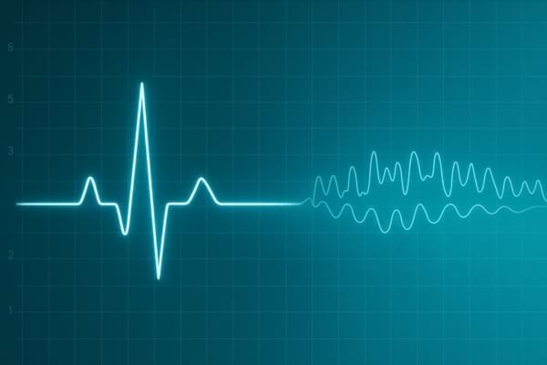 Moniteur cardiaque humain affichant une ligne plate passant lentement à de subtiles ondes cérébrales