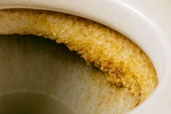 Tartre tres incruste et jaune sous le rebord interieur de la cuvette.