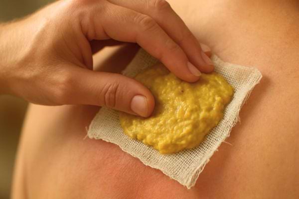 main appliquant un cataplasme a la moutarde sur la poitrine a travers une compresse