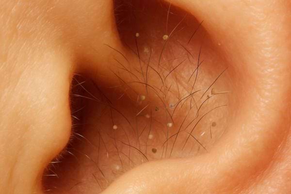 gros plan sur interieur dune oreille avec poils visibles