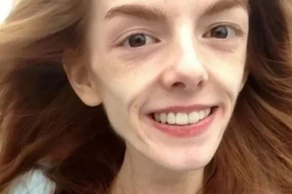 Une femme au visage décharné