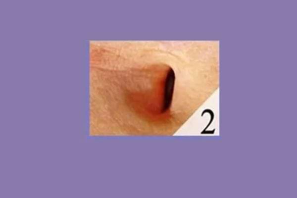 photo de nombril profond