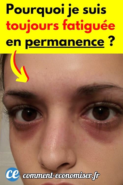 Une femme qui est fatiguée avec des cernes sous les yeux