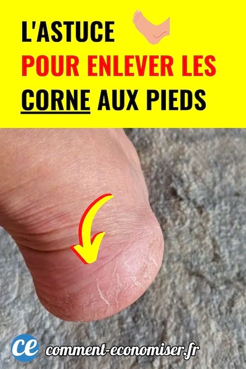 Une solution naturelle pour prendre soin de vos pieds &agrave; la maison. Id&eacute;al pour retrouver des pieds doux et nets.