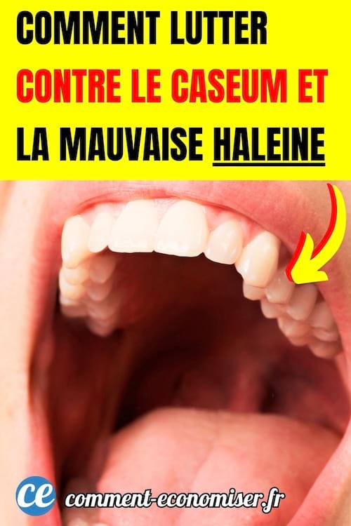 une bouche grande ouverte avec une vue sur les amygdales