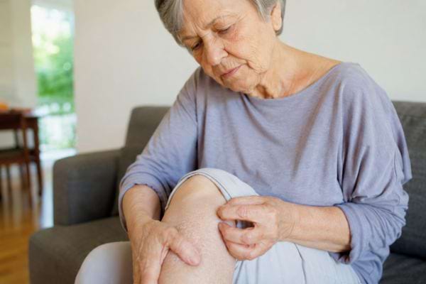 Femme &acirc;g&eacute;e examinant la peau s&egrave;che de sa jambe.