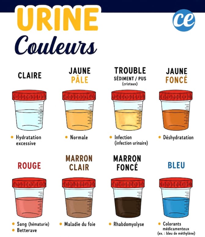 Les diff&eacute;rentes couleurs d'urine et leur signification