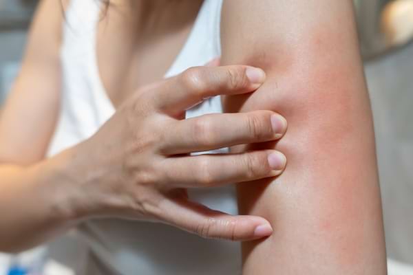 une personne se gratte le haut du bras