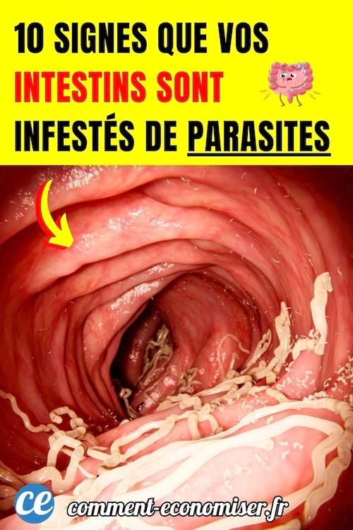 vue de l'int&eacute;rieur d'un intestin avec plein de parasites
