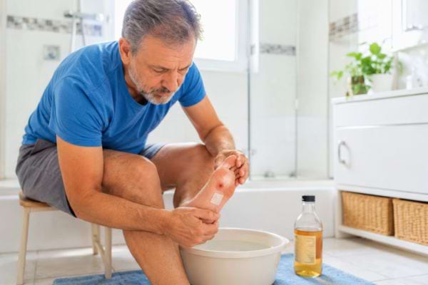 Homme appliquant un soin sur son pied après un bain au vinaigre de cidre