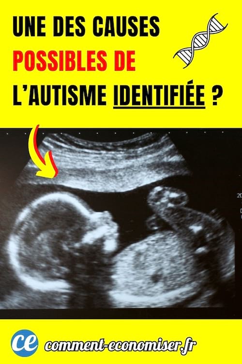 une échographie d'un bébé pendant la grossesse