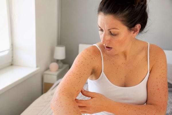Femme observant de petites taches rouges de psoriasis sur son bras.