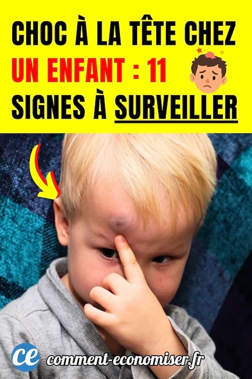 un petit enfant montre une grosse bosse qu'il a sur le front