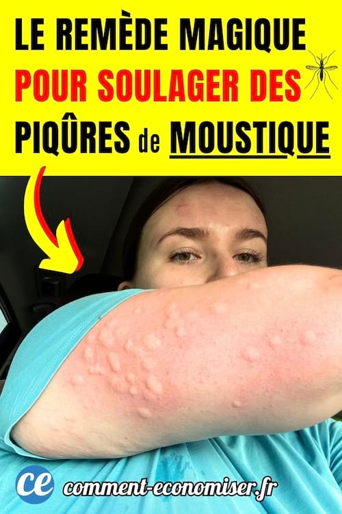 des piqûres de moustique qui démangent à soulager avec du bicarbonate de soude