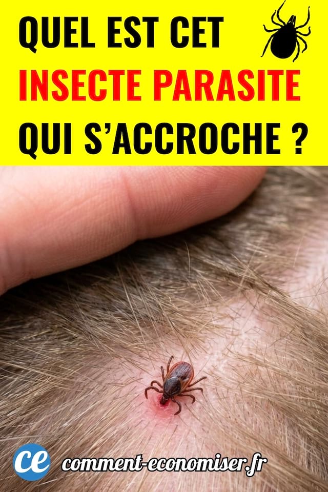 Une tique accrochée sur le cuir chevelu