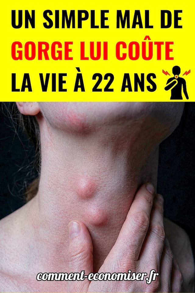 Une femme se tenant la gorges avec des boules apparentes sous la peau
