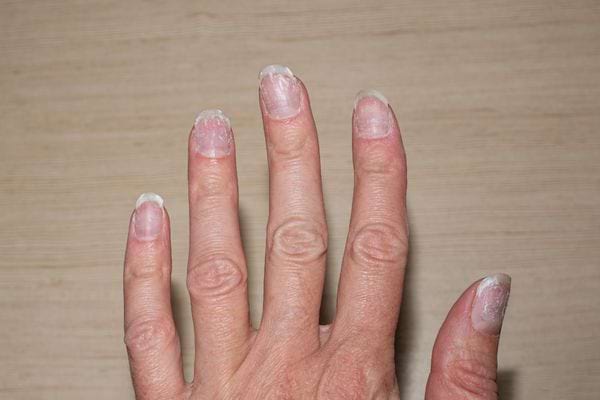 une main avec des ongles abîmés et mous à cause d'une manucure vernis gel